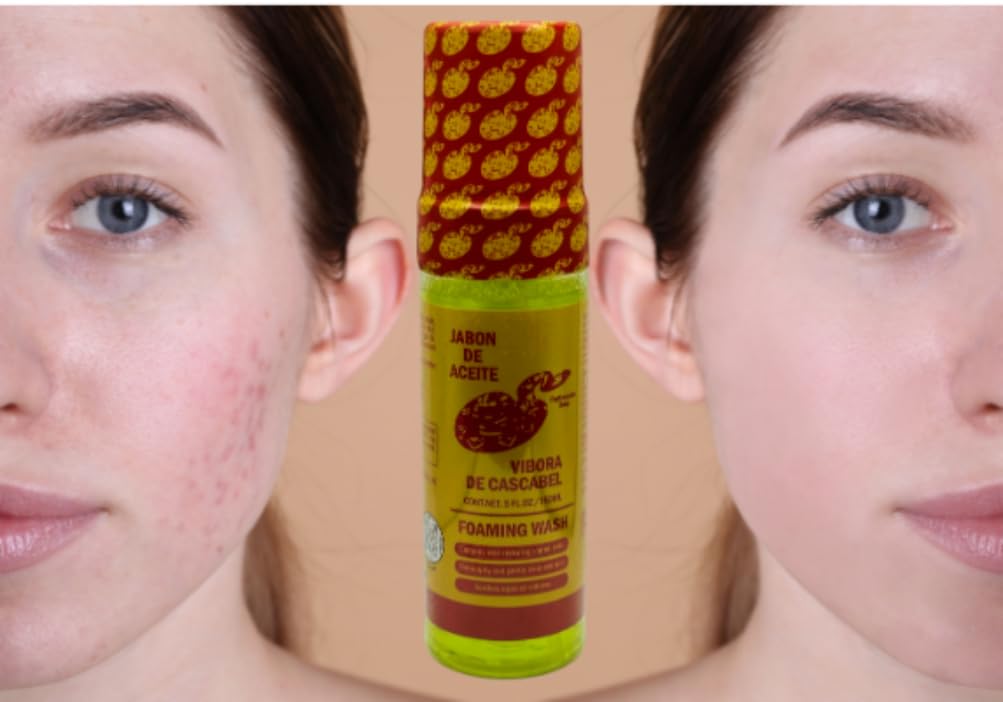 Jabón De Aceite de Vibora de cascabel (140g) + Foaming Wash Face & body (Jabón Líquido espumoso Para cara y Cuerpo) 150 ml Ayuda con imperfecciones en la piel ORIGINAL